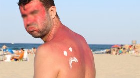 سلوكات خاطئة على الشواطئ تهدد بأمراض خطيرة