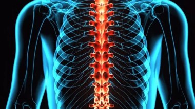 Sclérose en plaques: Une mutation génétique semble jouer un rôle selon une étude scientifique