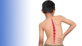 “السكوليوز”.. مرض يزداد انتشارا وسط الأطفال والمتمدرسين