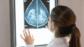 علماء ينجحون في “اختراق سرطان الثدي” ويكشفون لغزه المحيّر!