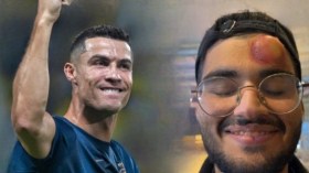 بِالفيديو: ماذا فعل رونالدو بِرأس المُصوِّر التلفزيوني؟