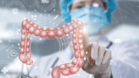 بعد تجاهل الأطباء لحالتها.. مريضة بسرطان القولون تحذر من هذه الأعراض!