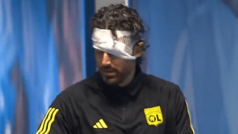 بالفيديو.. جماهير مارسيليا تعتدي على حافلة ليون وتصيب المدرب غروسو