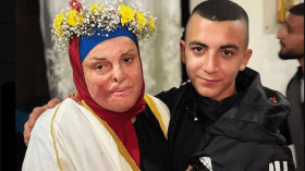 بعد دعوة أطباء التجميل العرب لعلاج الأسيرة إسراء جعابيص.. مستشفى أردني يعلن التكفل بالحالة