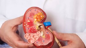 أمراض الكلى تزحف على الأطفال والشباب !