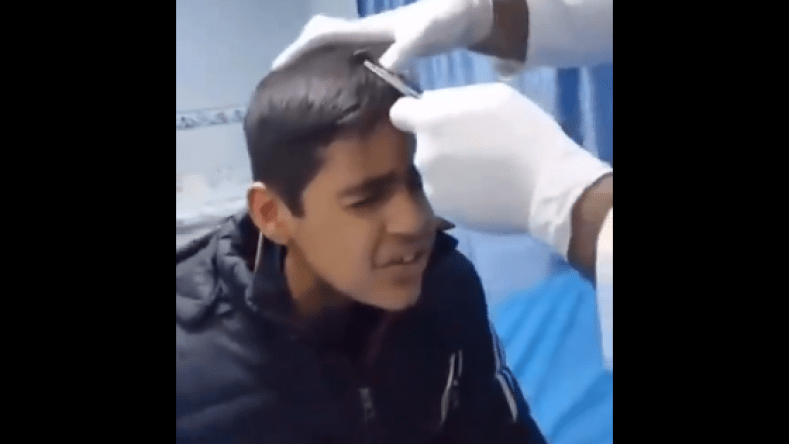 طفل فلسطيني يقرأ القرآن أثناء خضوعه لعملية دون تخدير.. هذه حقيقة الفيديو المتداول!