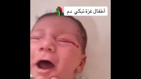 بالفيديو.. هذه قصة الرضيع الذي يبكي دما بدل الدموع!