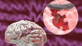 مسنة تصاب بسكتة دماغية بسبب فاتورة استهلاك المياه والشركة توضح!