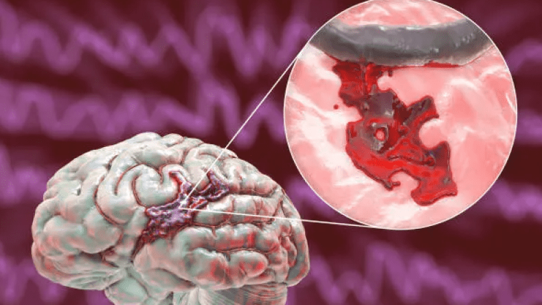 مسنة تصاب بسكتة دماغية بسبب فاتورة استهلاك المياه والشركة توضح!