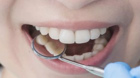 دراسة: نظافة الأسنان تحمي من مرض خطير