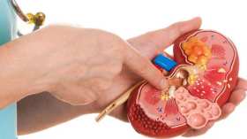 طبيبة روسية تنصج بهذه الأطعمة التي تخلص من حصوات الكلى وتقي منها!