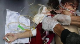 Arrivée des premiers blessés de Ghaza en Algérie