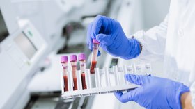 تحاليل طبية خارج القانون تهدد حياة المرضى