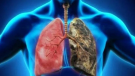 أفضل 11 طريقة لتنظيف الرئتين من السموم
