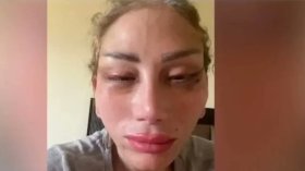 قضية الإعلامية ريهام سعيد.. تطورات صادمة بشأن ما تعرضت له أثناء عملية التجميل!