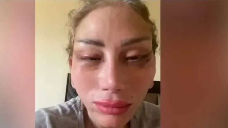 قضية الإعلامية ريهام سعيد.. تطورات صادمة بشأن ما تعرضت له أثناء عملية التجميل!