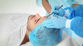 الرجال في الجزائر أكثر إقبالا على العمليات التجميلية في الخارج