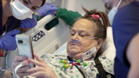 بعد 47 يوما فقط من زراعتها.. إزالة كلية الخنزير من جسد المرأة الأمريكية!