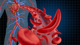 إذا كنت تعاني من فقر الدم فعليك أن تطلع على هذه المعلومات!