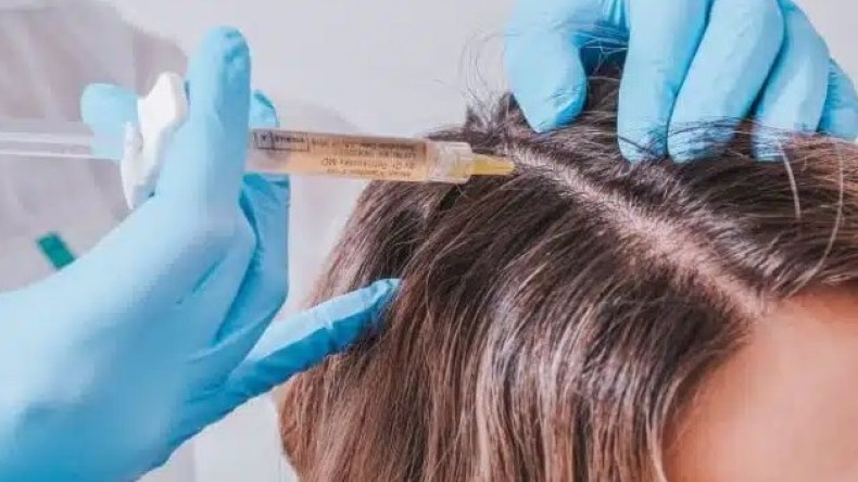 رغم تكلفته الباهضة.. إقبال كبير في صالونات التجميل على “فيلر الشعر”