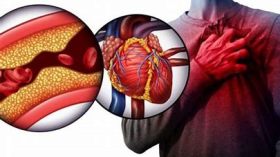 خطر الدهون الثلاثية على الجسم