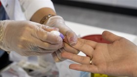 دراسة حديثة: هذه الفاكهة تقي من الإصابة بمرض خطير!