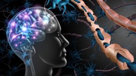 التصلب اللويحي.. نقص فيتامين د والجينات الوراثية هي السبب