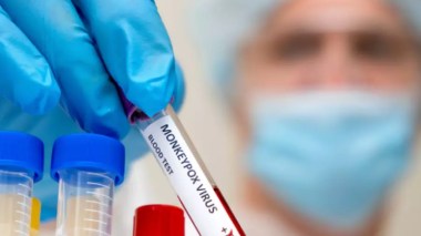 L’Afrique pourrait commencer la vaccination contre le mpox d’ici quelques jours