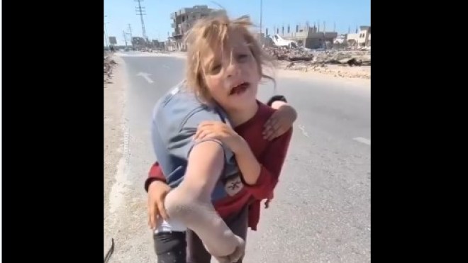 فيديو مأساوي لطفلة حافية القدمين تحمل شقيقتها المصابة يثير تفاعلا واسعا
