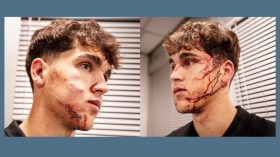 بِالفيديو والصّور: ما يُشبه الاعتداء بِسلاح أبيض في شارع ضيّق ليلا!