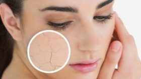 10 طرق فعّالة لتقليص حجم مسام الوجه