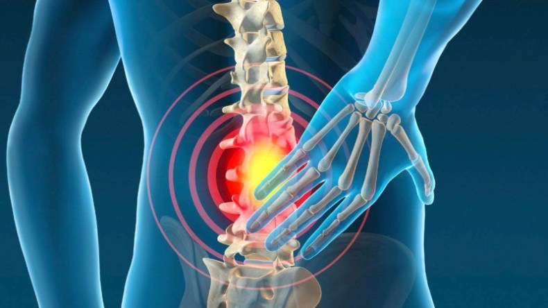 تعرّف على 10 أسباب شائعة لألم أسفل الظهر
