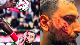 بالفيديو.. إصابة مرعبة لحارس باريس سان جيرمان دوناروما