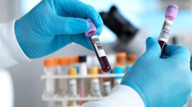 أخطاء التحاليل الطبية.. بداية رحلة الضياع في أروقة المستشفيات