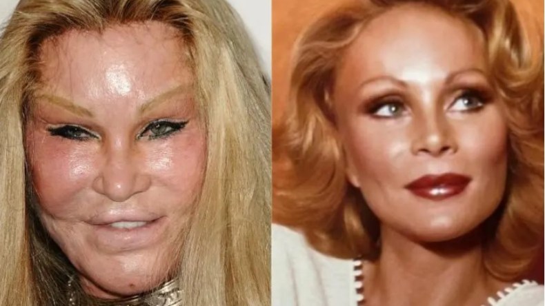 وفاة المليارديرة المعروفة بـ”المرأة القطة” تثير الجدل بشأن عمليات التجميل