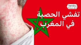 شبح أوبئة البدايات الأولى للكون يحوم حول قرعة الكرة في بلاد مراكش