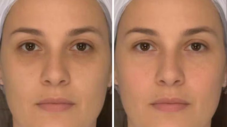 ماذا يقول وجهك عن صحتك؟ الأطباء يجيبون