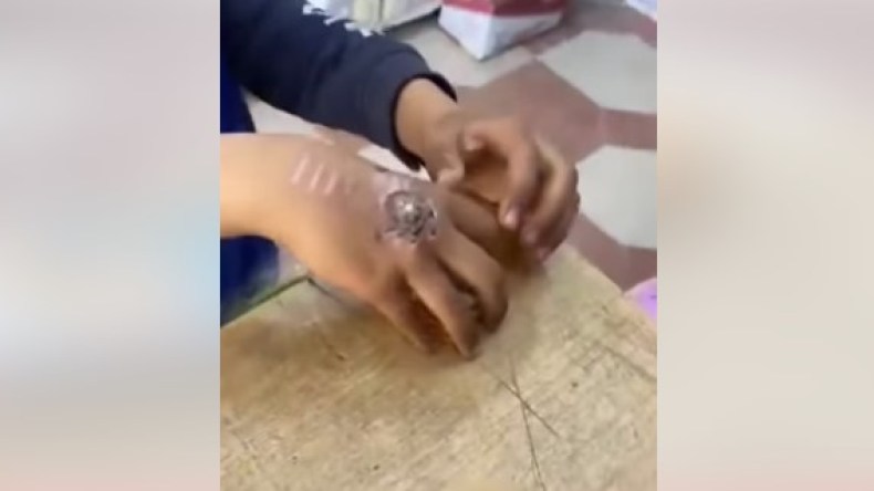 فيديو صادم.. أب يحرق يدي ابنه بشوكة بسبب 100 دج!