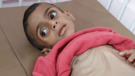 “حماس”: الاحتلال يكرّس التجويع في غزة تحت غطاء مشاريع إغاثية مضلّلة