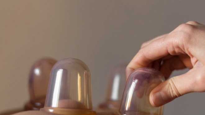 9 حالات لا يُنصح لها التداوي بالحجامة