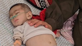 الجوع يفتك بقطاع غزة وتسجيل حالة وفاة جديدة لطفلة رضيعة