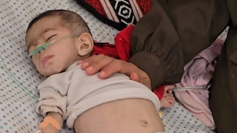 الجوع يفتك بقطاع غزة وتسجيل حالة وفاة جديدة لطفلة رضيعة