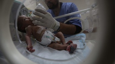 تحديات طبية للتقليل من معاناة الأطفال ذوي التشوهات الجنسيّة