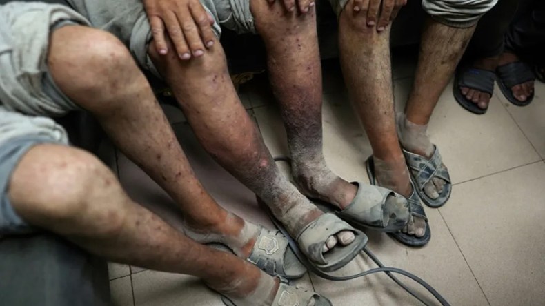 هيئة حقوقية تدعو لتحقيق دولي بجرائم التعذيب ضد الفلسطينيين