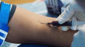 تحاليل طبية للكشف عن تعاطي المخدرات في ملفات الترشّح لمسابقات التوظيف