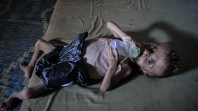 “أمهات غزة أُجبرن على إرضاع أطفالهن الماء بدل الحليب”