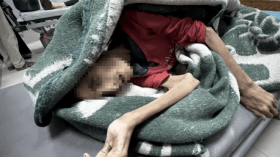 فارقت الحياة بوزن طفل.. فيديو صادم لشابة غزية يكشف فظاعة التجويع