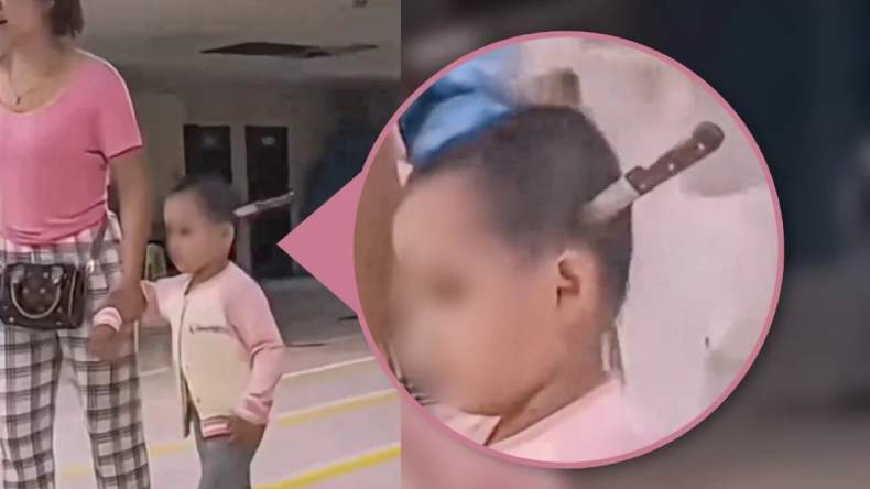 فيديو صادم لطفلة تسير داخل مستشفى وسكين مغروس في رأسها!