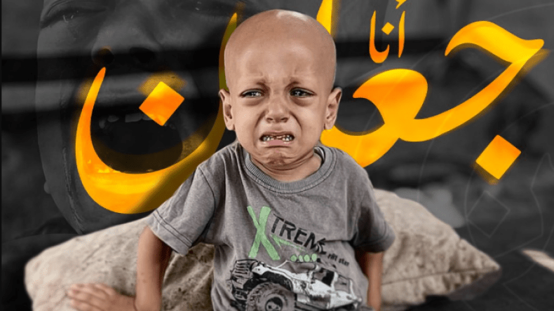 رحيل الطفل عبد الله صاحب صرخة “أنا جوعان”.. وهذا حال شقيقته حبيبة!