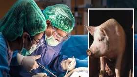 نجاح زراعة رئة خنزير في جسد إنسان.. هل اقتربنا من عصر بنوك الأعضاء الحيوانية؟